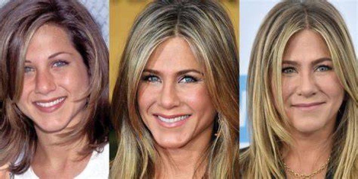 Has Jennifer Aniston Had Plastic Surgery